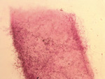 MISSING THUMBNAIL